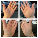 Hands Comparison May 2020.JPG