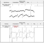 EMG4.jpg