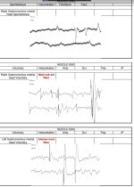 EMG5.jpg