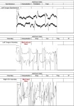 EMG7.jpg