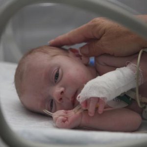 A human touch for a 20-day old Bulgarian girl born without her esophagus connecting to her stomach
