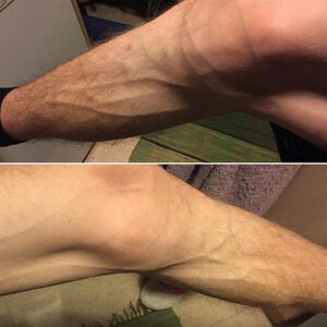 2015 Calf muscles.jpg
